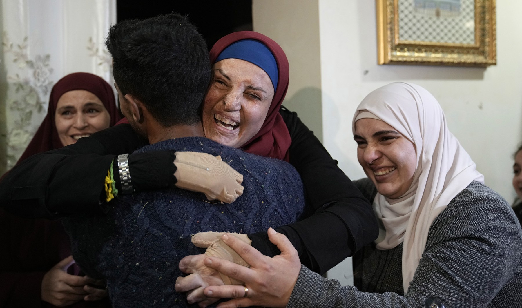 Israa Jaabis returns home after release from Israeli prison | Occupied East Jerusalem #Israa #Jaabis #returns #home #release #Israeli #prison #Occupied #East #Jerusalem